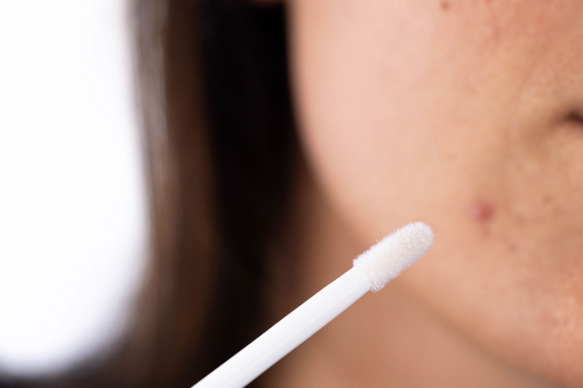 Blemish Treatment Stick