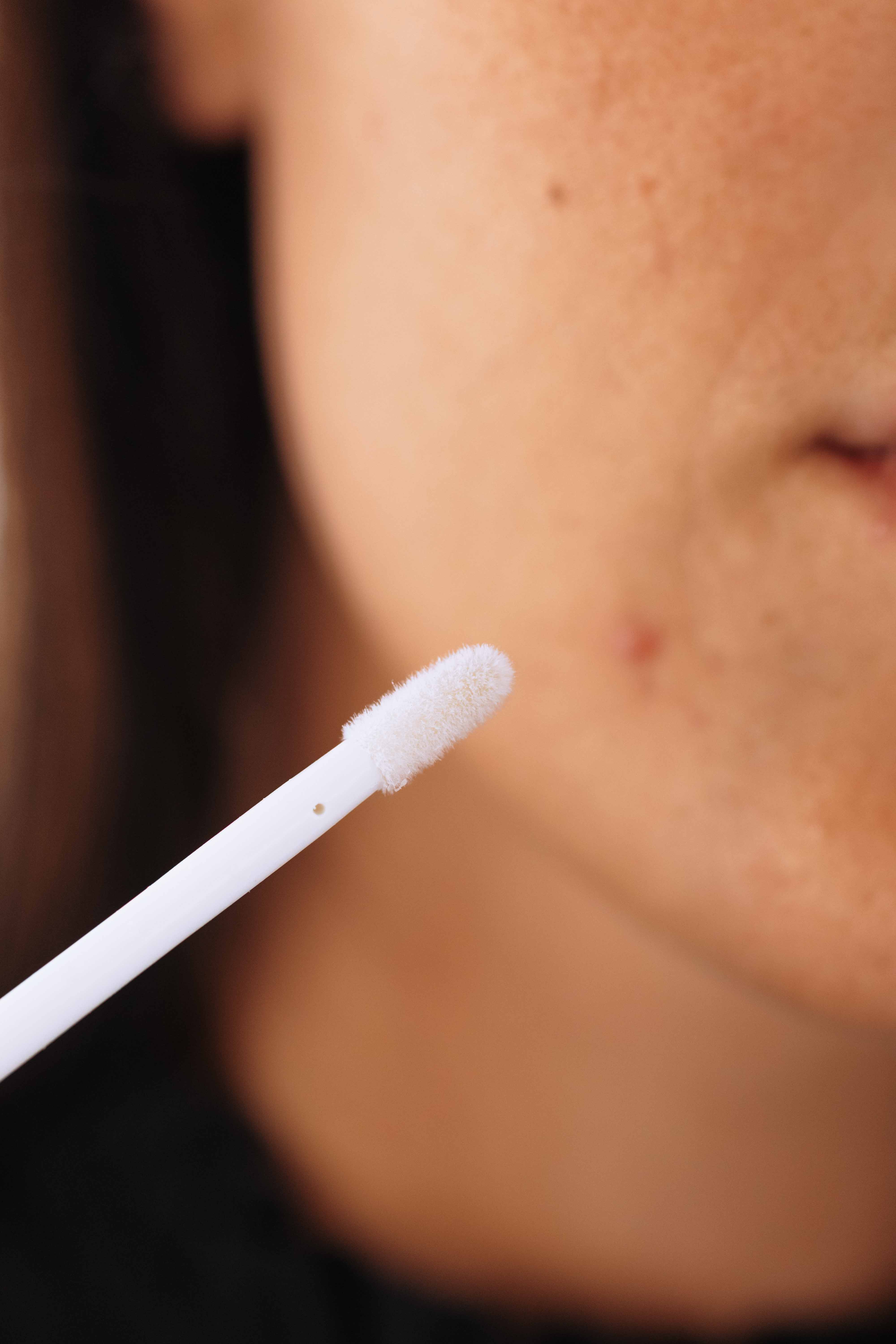 Acne Treatment Kit
